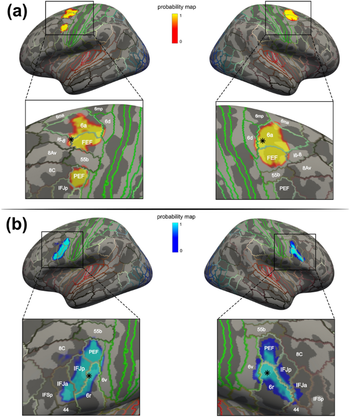 Figure from Accurate localization and coactivation profiles of the frontal eye field and the inferior frontal junction: an ALE and MACM meta-analysis
